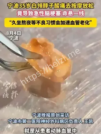 脑梗