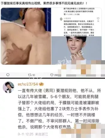 于朦胧尸检报告细节