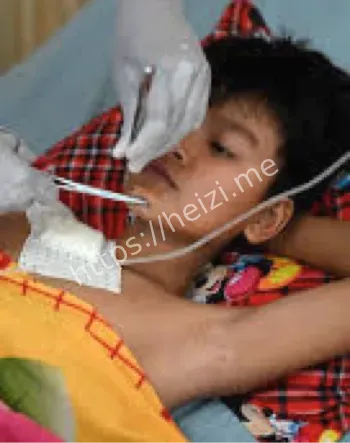 8小时脑部取出子弹细节